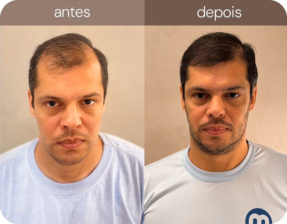 463190176_17923810940970824_1564719143296124487_n