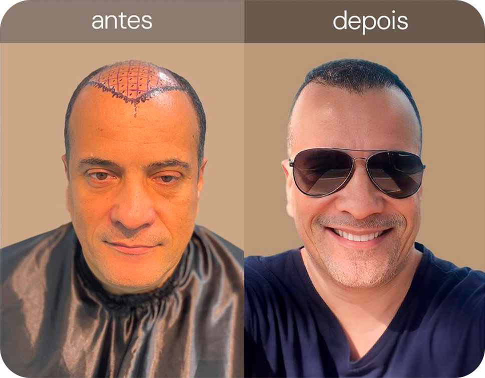 468128251_17929027538970824_1290239850478716902_n