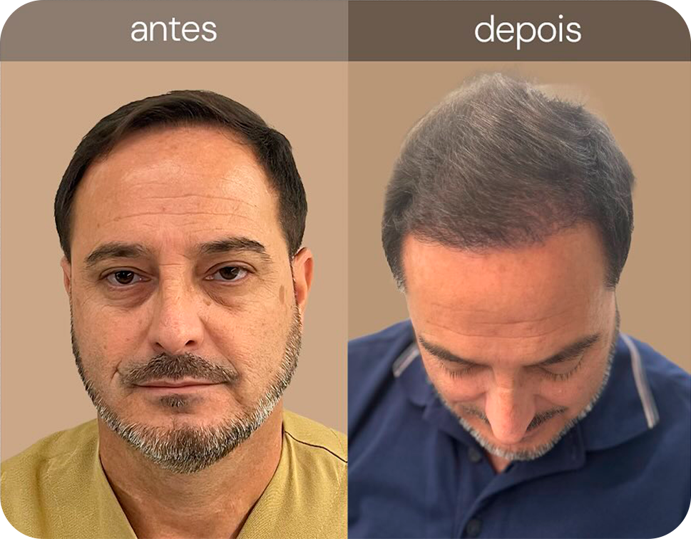 468420622_17929236212970824_6569691044034207958_n